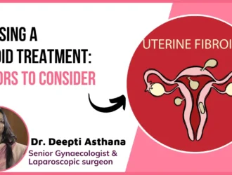 Fibroid Treatment