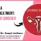 Fibroid Treatment