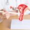 Uterus Removal Surgery