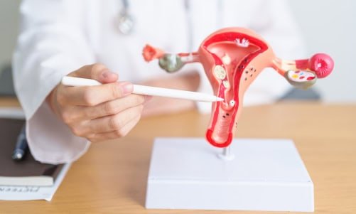 Uterus Removal Surgery