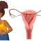 Bulky Uterus Treatment in Gurgaon