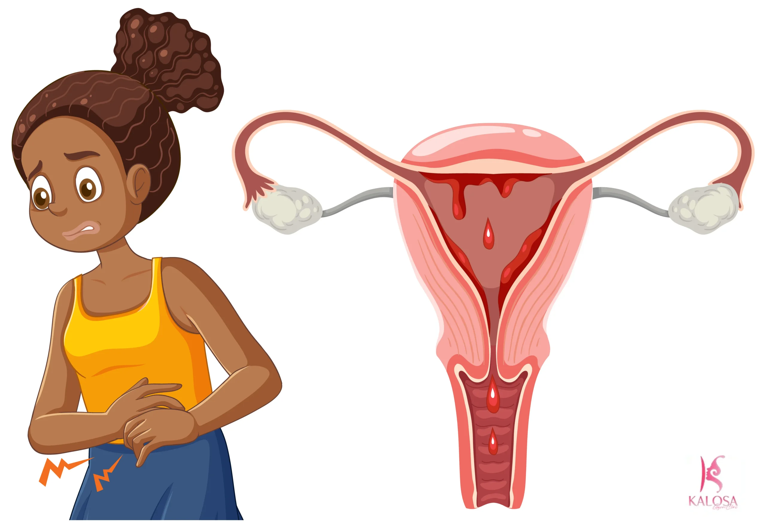 Bulky Uterus Treatment in Gurgaon