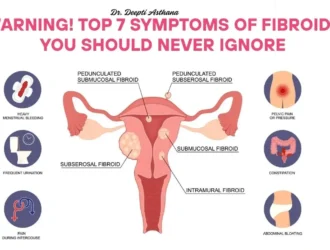 Fibroids