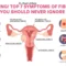 Fibroids