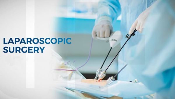 How to Choose the Best Doctor for Laparoscopic Surgery in Gurgaon 1 laparoscopic surgery