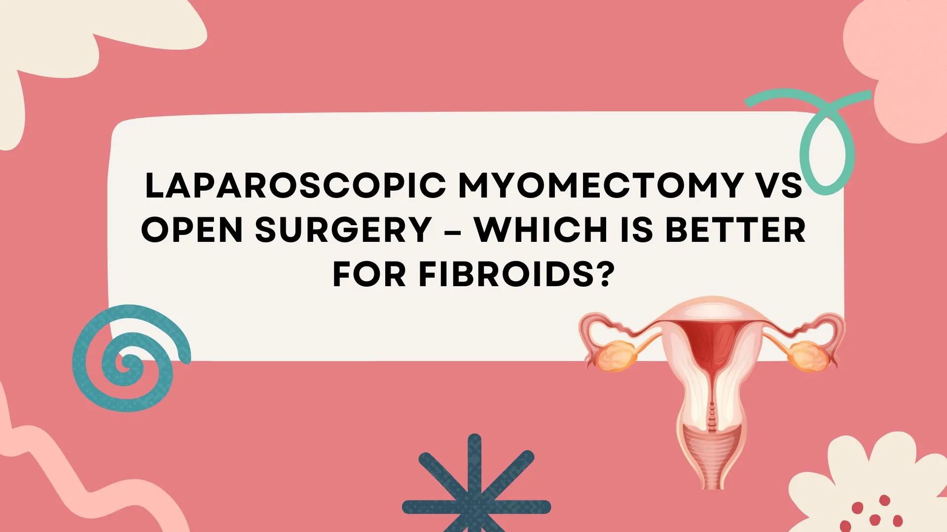 Laparoscopic Myomectomy vs Open Surgery – Which Is Better for Fibroids? 1 laparoscopic myomectomy Gurgaon