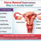 Uterus Removal