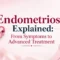 Endometriosis Explained From Symptoms to Advanced Treatment