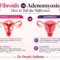 Fibroids vs Adenomyosis