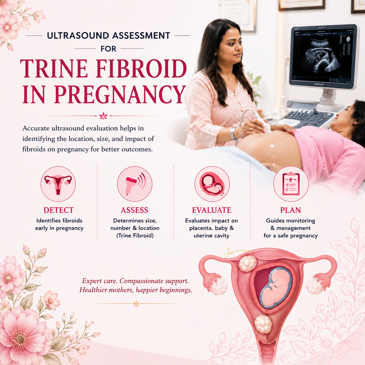 Ultrasound assessment for uterine fibroids in pregnancy