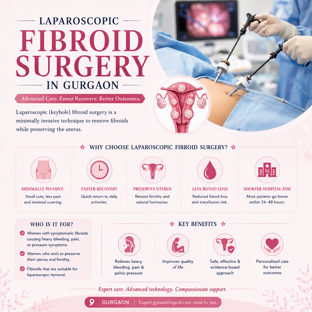 Laparoscopic fibroid surgery in Gurgaon