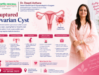 Ruptured Ovarian Cyst Symptoms and Treatment