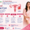 Ruptured Ovarian Cyst Symptoms and Treatment