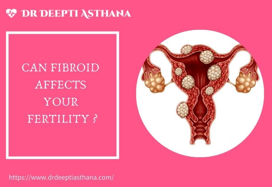 Fibroid-fertility