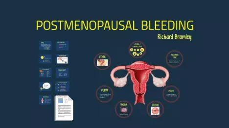 Postmenopausal bleeding is vaginal bleeding that happens after a